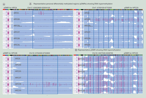 Figure 3.  Personal differentially methylated regions in human normal purified hepatocytes. (A) Representative pDMRs (blue boxes) showing DNA hypermethylation (a: HPC6, HPC20 and HPC28) and DNA hypomethylation (b: HPC25) based on the definition shown in Supplementary Figure 8 (page 316). (B) The ratio of pDMRs belonging to TSS1500, TSS200, 5′ UTR, first coding exon, first intron, gene body, 3′ UTR and intergenic region for all pDMRs in each sample (pie charts) and the average ratios of the number of pDMRs per total number of 100-bp windows on autosomes that contain CpG sites and belong to TSS1500, TSS200, 5′ UTR, first coding exon, first intron, gene body, 3′ UTR and intergenic region in all six samples (bar graph). pDMRs in TSS200s (*) were less frequent than those in TSS1500 (p = 2.550 × 10-2), 5′ UTR (p = 1.755 × 10-2) and intergenic region (p = 6.466 × 10-3). pDMRs in first coding exons (†) were less frequent than those in TSS1500 (p = 7.647 × 10-3), 5′ UTR (p = 3.385 × 10-3), first intron (p = 5.665 × 10-3), gene body (p = 1.030 × 10-2), 3′ UTR (p = 6.319 × 10-3) and intergenic region (p = 6.294 × 10-3). pDMRs in TSS1500 (¶) were less frequent than those in 5′ UTR (p = 5.451 × 10-4), first intron (p = 4.724 × 10-3), gene body (p = 2.846 × 10-2) and intergenic region (p = 6.743 × 10-3). (C) pDMRs in CpG island (§) were less frequent than those in N-Shelf (p = 2.010 × 10-2), N-Shore (p = 5.850 × 10-3), S-Shore (p = 6.111 × 10-3), S-Shelf (p = 8.473 × 10-3) and open sea (p = 5.695 × 10-3).Chr: Chromosome; pDMR: Personal differentially methylated region; UTR: Untranslated region.