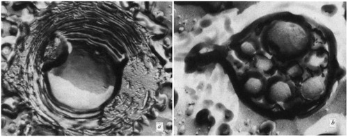 Figure 5. Electron micrographs of freeze-etched oleic acid spheres (× 41,650). (A) A central aqueous region surrounded by concentric membranes- the flat pitted area was cut by the microtome. (B) Smaller spheres enclosed by a common envelope. [Used with the permission Gebicki and Hicks Citation1973].