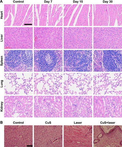 Figure 6 (A) Histological images of the HE-stained heart, liver, spleen, lung, and kidney harvested from mice after treatment with PTT rendered by PEG-DA-CuS NPs or from mice treated with nothing as the control group. (B) Histological images of the H&E-stained skin harvested from mice after different treatments (treated with nothing as the control group, injected with PEG-DA-CuS NPs alone, laser irradiation alone, and injected with PEG-DA-CuS NPs and irradiated with 1,064 nm laser). We selected four nude mice and picked the skin tissues in the same location of the mice body to conduct the histological analysis. The scale bar is 50 μm.Abbreviations: NPs, nanoparticles; PEG, polyethylene glycol; PTT, photothermal therapy.