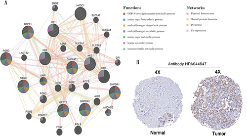 Figure 10 Protein–protein interaction network and IHC slices of GNPNAT1. (A) Protein-protein interaction network of GNPNAT1. (B) IHC slices of GNPNAT1.