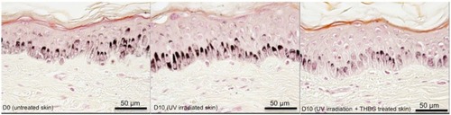 Figure 6 Visualization of melanin content in skin explants cultured after irradiation and in presence or not of THBG at 2% (histological analysis, Fontana Masson staining).