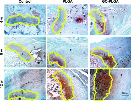 Figure 6 Representative histology images of the cartilage tissue at the insertion site (40× magnification).Notes: Yellow region indicates newly formed cartilage between supraspinatus tendon and bone. Scale bars for H&E-stained images=200 µm.Abbreviations: GO, graphene oxide; PLGA, poly(lactic-co-glycolic acid); B, bone; I, interface; T, tendon; W, weeks.