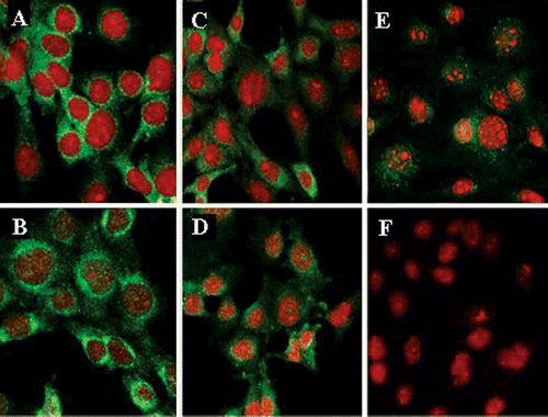Figure 5. Confocal microscopy analysis of the intracellular localization of p65 (a, b) or IκBα (c–f) in WT (a–d) or p65−/− (e, f) cells that were not exposed (a, c, e) or exposed to heat shock and analyzed 4 h later (b, d, f) (red staining: nuclei stained with PI; green staining: expression of p65 or IκBα) (1 representative out of 3 experiments) (X450).
