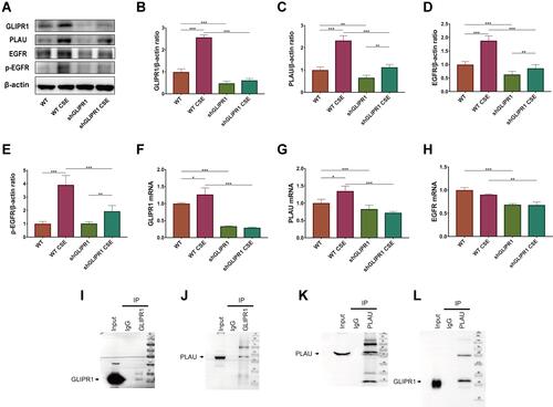 Figure 6 GLIPR1 knockdown reduced PLAU/EGFR signaling in vitro. (A) Levels of GLIPR1, PLAU, EGFR, p-EGFR, and β-actin proteins in human bronchial epithelial (HBE) cells were measured by Western blotting analysis. Quantitative analysis of (B) GLIPR1, (C) PLAU, (D) EGFR, and (E) p-EGFR. mRNA levels of (F) GLIPR1, (G) PLAU, (H) EGFR. (I) GLIPR1 was pull downed by Western blotting using anti- GLIPR1 antibody. (J) Immunoprecipitation assay showed that PLAU was pull downed by GLIPR1. (K) PLAU was pull downed by Western blotting using anti- PLAU antibody. (L) Immunoprecipitation assay showed that GLIPR1 was pull downed by PLAU. Error bars represent SD. *P < 0.05; **P < 0.01; ***P < 0.001. shRNA vectors targeting GLIPR1.