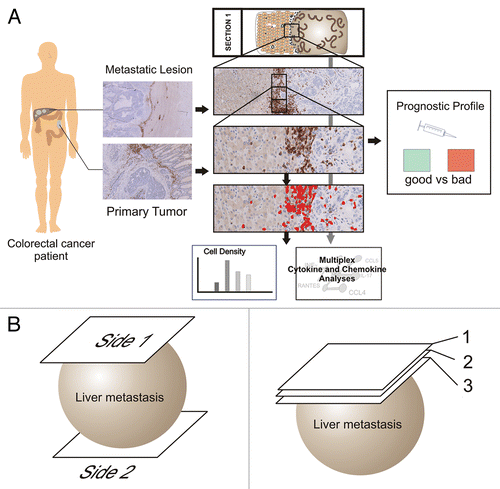 Figure 1. Analytical steps. (A) Workflow for immune cell quantification, cytokine analysis and subsequent generation of a prognostic profile. (B) Analysis of opposite sides of a metastatic lesion. (C) Analysis of serial sections of a metastatic lesion.