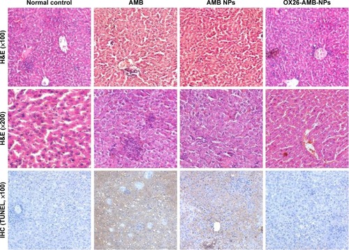 Figure 7 Using TUNEL assay in rats, hepatic histopathology and immunohistochemistry were used to detect cell inflammation and cell apoptosis.Notes: PBS-treated normal control, showing normal lobular architecture and cell structure; AMB-treated group, showing extensive hepatic centrilobular damage characterized by the presence of vacuolization and severe apoptosis; AMB NPs-treated group, showing modest hepatic centrilobular degeneration and apoptosis; OX26-AMB-NPs, showing lobular architecture and cell structure similar to the normal control.Abbreviations: AMB, amphotericin B; H&E, hematoxylin and eosin stain; IHC, immunohistochemistry; NP, nanoparticle; OX26, TfR monoclonal antibody of rats; PBS, phosphate-buffered saline; TfR, transferrin receptor; TUNEL, terminal deoxynucleotidyl transferase-mediated dUTP-biotin nick end labeling assay.