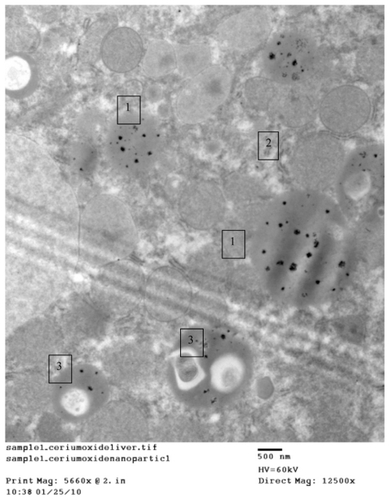 Figure 3A 1) Regular distribution of cerium oxide (CeO2) nanoparticles intracellular in the endosomes. 2) Homogenous appearance of cytoplasm with no abnormal vaculation, original magnification ×12,500. 3) Regular distribution of CeO2 nanoparticles within normal lysosomes.