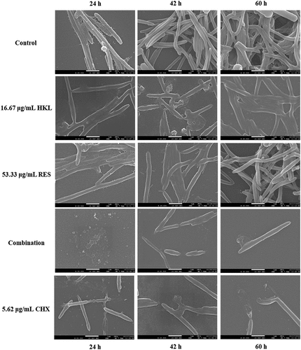 Figure 5. Observe the effect of drugs on the Fn biofilm morphological structure at different stages by SEM (×20000).