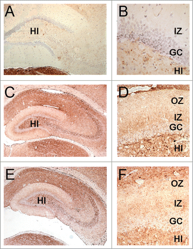 Figure 7. The lamination pattern observed in the hippocampal molecular layer corresponds to differential PrP labeling on synapses from specific areas. PrP-immunohistochemistry (3F4 antibody) of hippocampal sections from infected hamsters. (A, B) 263K scrapie agent (IP: ∼80 dpi). (C, D) inoculum 8.1 (3rd passage; IP: ∼80 dpi). (E, F) inoculum D (2nd passage; IP: ∼80 dpi). Lamination pattern corresponding to synaptic PrP immunostaining. (B, D, and F) Granular/punctate PrP depositions. HI (hilus), GC (granule cells), IZ (inner zone of the molecular layer), OZ (outer zone of the molecular layer). Magnification: (A) (x100), (B) (x400) (C and E) (x50), (D and F) (x200).