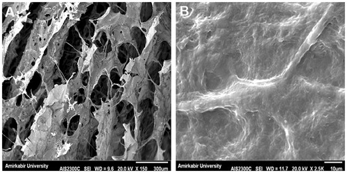 Figure 1. SEM morphological photographs can be seen as a three-dimensional open porous and interconnected porosity (A). Cells can be observed in the hydrogel, grown and legs spread out (B).