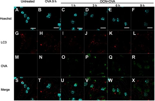 Figure 6 OVA delivered by OCNs did not colocalize with autophagosomes. OCN+OVA-fluorescein conjugate (ratio 3:1, green) were incubated with BMDMs. After the indicated incubation times at 37°C, cells were subjected to immunofluorescence staining using anti-LC3 antibody and anti-rabbit IgG (H+L), F(ab’)2 fragment conjugated with Alexa Fluor® 555 antibody for autophagosomes (red). Nuclei were stained with Hoechst (blue). Images were acquired by confocal microscopy. (A–F) Hoechst, (G–L) LC3, (M–R) OVA-fluorescein conjugate, (S–X) merged images. Scale bar=10 µm.