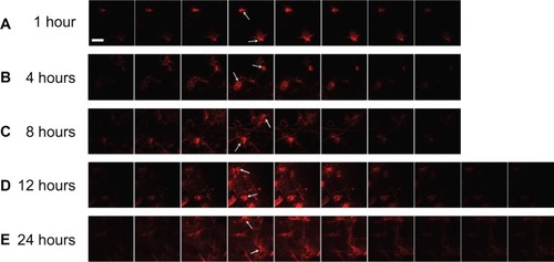 Figure 6 CLSM images of a z-series (sequential xy sections, interval =60 μm) after application of NLC-MNs to minipig skin for (A) 1 hour, (B) 4 hours, (C) 8 hours, (D) 12 hours, and (E) 24 hours.Notes: The arrows indicate the spot pierced with the MNs. The white scale bar represents 500 μm.Abbreviations: CLSM, confocal laser scanning microscopy; NLC-MNs, nanostructured-lipid-carrier-loaded microneedles; MNs, microneedles.