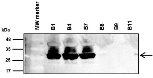 Figure 3. Immunodetection of CarO in outer membrane protein profiles. Outer membrane fractions were extracted from the bacteremic CRAB clinical isolates from non-surviving patients (B1, B4, and B7) and from surviving patients (B8, B9, and B11), and subjected to sodium dodecyl sulfate polyacrylamide gel electrophoresis (SDS-PAGE), followed by immunoblotting with polyclonal rabbit antibodies toward A. baumannii CarO. Molecular weight standards (kDa) are shown on the left. Black arrow on the right indicate the final position of CarO. MW, molecular weight