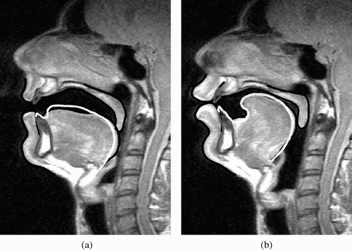 Figure 9. Comparison of MRI data (black contour) with AnTon (white contour) in pre-vocalisation experiments: (a) vowel/a/; (b) vowel/u/. MRI data by courtesy of Badin and Serrurier Citation2006.