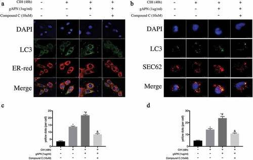 Figure 7. Effect of inhibiting AMPK using compound C (10 µM) on ER-phagy and SEC62 expression in H9C2 cardiomyocytes exposed to CIH (48 h), gAPN (1 µg/ml). (a, c) Fluorescence staining of LC3 (green) co-localized with the ER probe (red). Nuclei were stained with DAPI (blue). The scale bars represent 20 μm. (b, d) Fluorescence staining of LC3 (green) co-localized with the SEC62 (red). Nuclei were stained with DAPI (blue). The scale bars represent 10 μm. Data represent mean ± SD. n = 3. *P< 0.05, vs NC group. #P< 0.05, vs CIH group. &P< 0.05, vs CIH+gAPN group