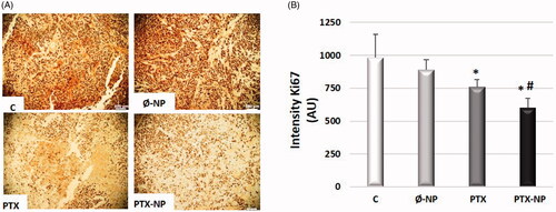 Figure 2. Anti-proliferative effects of PTX-NPs in HNSCC model. (A) Representative micrographs of immunostaining with Ki67 of all treatment groups. Cell nuclei are identified with immunoreactivity for Ki67 marked in brown. 100 mm scale bar. Capture of representative images was performed randomly, blindly; Mice treated with: C (control); Ø-NP (unloaded NPs, 1 mg/ml; PTX (Paclitaxel, 5 mg/kg); and PTX-NP (Paclitaxel loaded NPs, 5 mg/kg) for 21 days; (B) Quantification of immunostaining for Ki67 measured by the ImageJ program. The diagrams for Ki67 represent the mean ± SD of arbitrary units (AU) *p < .05 versus C and Ø-NP groups; #p < .05 versus group PTX. (n = 20).