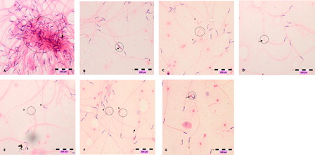Figure 3. Photomicrographs show abnormal sperms, (A) clumping, (B) head deformity (arrow), (C) hookless (a) and coiled tail (b), (D) bent-tail (arrow, (E) broken-head (a) neck's defect (n), (F) broken head (a), broken tail (b) and bent tail (arrow), (G) double head (arrow). Slides were stained with haematoxylin-eosin dye. Scale, 100 µm.
