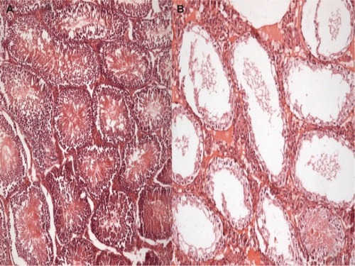 Figure 2 Johnsen score, hematoxylin and eosin staining in postpubertal periods.