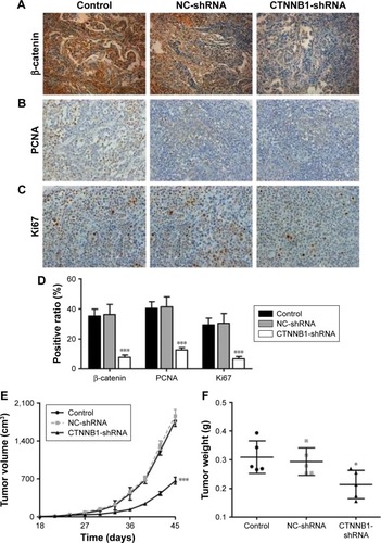 Figure 6 CTNNB1 regulated tumor growth in vivo. Xenograft tumor from nude mice was injected with A498 cells stably expressing CTNNB1-shRNA or negative control (NC-shRNA) as described in “Materials and methods.” Expressions of β-catenin (A and D), PCNA (B and D), and Ki67 (C and D) were determined by immunohistochemistry staining. Magnification, × 200. (E) Growth curve of tumor volumes. (F) Tumor weights. Data are presented as mean ± SD. *P<0.05, ***P<0.001 compared with control groups.