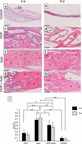 Figure 4. Higher magnified images of rat calvarial defect regions in the sections with haematoxylin-eosin staining at 4 weeks (a, c, e, g) and 8 weeks (b, d, f, h) of implantation of no materials (Control) (a, b), OCP (c, d), autogenous bone (e, f), and mixture of OCP and bone (g, h). Bars in the images represent 250 μm. Asterisks and ‘a’ indicate remaining OCP and autogenous bone; ‘n’ indicates newly formed bone, respectively. Histomorphometric analysis of newly formed bone in defects without and with implantation of OCP, autogenous bone (Auto), and mixture of OCP and Auto at 4 and 8 weeks (i) (*p < 0.05, **p < 0.01)