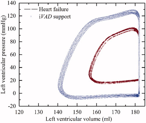 Figure 8. The pressure-volume loop of the failing ventricle before and after iVAD support at 150 mmHg drive pressure.