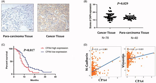 Figure 6. CPA4 expression up-regulated in NSCLC predicted poor prognosis. (A) Representative images of expression of CPA4 in NSCLC tissues and para-carcinoma tissues. Scale bars, 100 µm. (B) The expression of CPA4 in NSCLC tissues was significantly increased compared with that of para-carcinoma tissues. (C) Kaplan–Meier survival analysis of CPA4 expression in patients with NSCLC subdivided with two groups. NSCLC with high expression of CPA4 has shorter survival. (D) The RNA expression of N-cadherin and Vimentin is positively correlated with CPA4 from TCGA datasets.