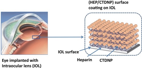 Figure 1 Schematic illustration of drug-eluting hydrophilic coating-modified IOL fabricated via layer-by-layer deposition of heparin and drug-loaded chitosan nanoparticles.