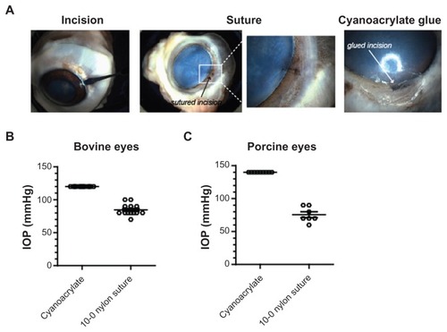 Figure 3 Comparison of tensile strength using tissue adhesive or sutures. (A) Representative images of porcine cadaver eyes with clear corneal incisions using a 2.5 mm crescent-angled knife, incision closed by suture, or using cyanoacrylate-based tissue adhesive. (B) Clear corneal incisions did not show leakage at sustained intraocular pressure of 120 mmHg in bovine eyes, whereas leakage and compromised wound integrity were observed in sutured eyes at 84 ± 2 mmHg (n = 13). (C) Porcine eyes showed a similar tensile strength after suturing 76 ± 4 mmHg (n = 7), while wounds closed with glue withstood 140 mmHg pressure.