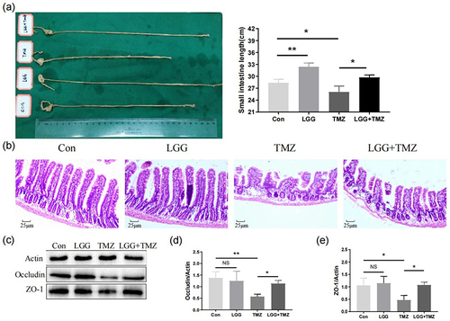 Figure 2 LGG alleviated TMZ-induced damage to the intestinal villus structure and barrier function. (a) Length (cm) of small intestine of mice in the four groups on day 14; (b) hematoxylin and eosin staining of the intestinal villi of mice in the four groups on day 14; (c–e) expression of occludin and ZO1 in small intestinal tissue of mice in the four groups on day 14. *P<0.05, **P<0.01.