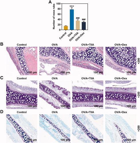 Figure 2. OVA increased the number of nasal rubbing in mice, inflammatory response, goblet cell and mast cell in nasal mucosal tissue of OVA-induced AR mice, while both TIIA and Dex inhibited the effect of OVA. (A) The nasal rubbing of mice was observed and its number was counted. (B) Inflammatory cells in nasal mucosal tissue were detected by H&E staining. (C) Goblet cells in nasal mucosal tissue were determined by PAS staining. (D) Mast cells in nasal mucosal tissue were observed by Giemsa staining. ***p < 0.005, ###p < 0.005, * vs. control; # vs. OVA.