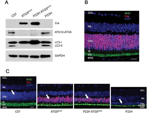 Figure 5. Genetic deletion of autophagic gene Atg5 specifically in rod photoreceptors of P23H mice to generate P23H ATG5Δrod mice. (a) Representative western blots probed for LC3, ATG12–ATG5 conjugate, SQSTM1, and loading control GAPDH from retinas of C57, ATG5Δrod, P23H ATG5Δrod, and P23H mice at 2 months of age (n = 4). (b) Retinal section from a 2-month-old P23H ATG5Δrod mouse probed for RHO (green) and Cre (red), with DAPI staining (blue). (c) Retinal sections from 6-month-old C57, ATG5Δrod, P23H ATG5Δrod, and P23H mice probed for RHO (green) and Cre (red), with DAPI staining (blue). White arrows point to the ONL, where the photoreceptor nuclei reside. Scale bar: 20 µm. Retinal cell layers labeled as in Figure 3.
