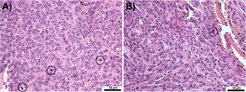 Figure 5. (A) H&E staining (40×) for untreated GL261 and (B) LL/2-Luc2 tumors. Both tumors show solid, dense, hypercellular growth with large, atypical nuclei and prominent mitotic activity (circles). GL261 tumors tend to grow in more circumscribed pattern, while LL/2-Luc2 tumors show more aggressive growth with tumor islands infiltrating surrounding parenchyma and perivascular spaces.