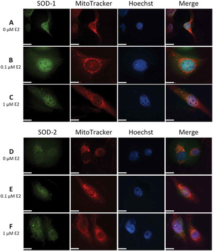 Figure 3. Immunolocalization of superoxide dismutases, SOD-1 and SOD-2, in human lens epithelial cells (HLECs) after exposure to 17β-estradiol (E2) for 1.5 h.Nuclear morphology is shown with Hoechst 33342 and MitoTracker Deep Red FM was used for mitochondrial localization. Cells were labeled with antibodies against SOD-1 and SOD-2 and visualized by Alexa Fluor 488. Immunolabeling in the cytosol and nucleus was seen with SOD-1 antibody (A, B, C) Mitochondrial localization was evident by colocalization of SOD-2 with MitoTracker (D, E, F). Original magnification: 1000×. Scale bar: 20 µm.