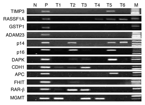 Figure 1 Representative results of MSP analysis of the methylated form of 12 tumor-related genes. M, markers; N, negative control (water blank); P, positive control (universal methylated DNA); T, tumor samples. Samples were scored as methylated when there was a clearly visible band with the methylated primers.