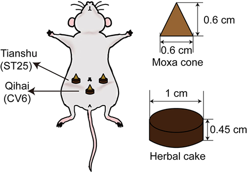 Figure 1 Illustration of herb-partitioned moxibustion. HPM treatment was administered by placing a moxa cone on the top of an herbal cake at the Tianshu (ST25, bilateral) and Qihai (CV6) points and igniting it.