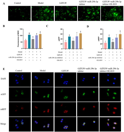 Figure 4. GZFLW regulates H19/miR-29-3p to inhibit autophagy. (A) Fluorescence image of autophagy vesicles after MDC staining. (B) The number of autophagy vesicles. (C and D) The number of autophagosomes and autophagy polymers. (E) Fluorescent images of autophagosomes (green) and autophagy polymers (red). #p < .05, ##p < .01 in comparison with controls, **p < .01 in comparison with model, &p < .05 in comparison with GZFLW.