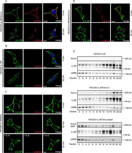 FIG 6 Influence of SorLA and the cytoplasmic IL-6R domain on the internalization and localization of IL-6R in cells. HEK293 transfectants expressing IL-6R (B) or IL-6RΔtail alone (C) or coexpressed with SorLA (A and D) were incubated (4°C, 2 h) with mouse anti-IL6R and rabbit anti-SorLA, washed, and then reincubated at zero time in warm media (37°C) supplemented or not supplemented with 25 nM IL-6. At the indicated times (0 and 25 min), the cells were fixed, permeabilized, and stained with Alexa Fluor 488-conjugated goat anti-mouse and Alexa Fluor 568-conjugated goat anti-rabbit antibodies. (E) HEK293 cells transfected with IL-6R, IL-6R/SorLA, or IL-6R/SorLAΔtail were subjected to subcellular fractionation. The fractions were subjected to Western blotting and probed with antibodies against SorLA, IL-6R, and cd49b (control). Scale bars, 10 μm.