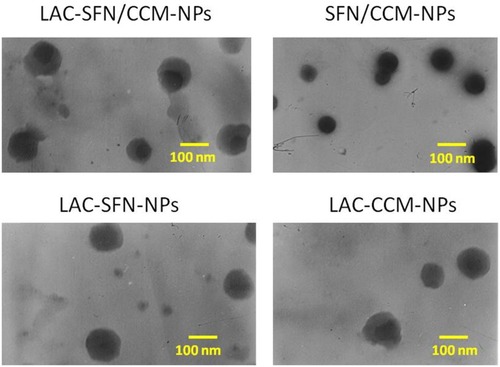 Figure 2 TEM images of LAC-SFN/CCM-NPs, SFN/CCM-NPs, LAC-SFN-NPs, and LAC-CCM-NPs. LAC-SFN/CCM-NPs are spherical particles with light coats on the surface, while SFN/CCM-NPs showed uniform particles with smooth surfaces.