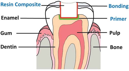 Figure 1. Illustration of the tooth and position of a primer, bonding, and resin composite.