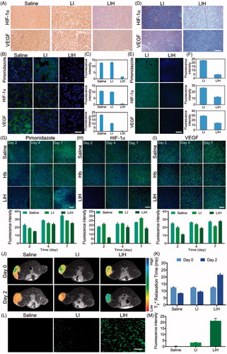 Figure 5. Effects of LIH on tumor hypoxia alleviation. (A) The expression of HIF-1α and VEGF in CT-26 subcutaneous tumor model mice treated with saline, LI, or LIH. Scale bar, 100 μm. (B) Representative immunofluorescence images of tumor slices after hypoxia staining. Scale bar, 50 μm. (C) The relative hypoxia positive area, HIF-1α ,and VEGF receptor were recorded from more than ten micrographs for each group by ‘Image J’ software. (D) The expression of HIF-1α and VEGF in CT-26 orthotopic tumor of mice treated with LI or LIH. Scale bar, 100 μm. (E) Representative immunofluorescence images of tumor slices after hypoxia staining. Scale bar, 100 μm. (F) The relative hypoxia positive area, HIF-1α,and VEGF receptor were recorded from more than 10 micrographs for each group by ‘Image J’ software. (G) Representative immunofluorescence images and semi-quantitative analysis of tumor slices after hypoxia staining by antipimonidazole antibody (green). Scale bar, 100 μm. (H) Representative immunofluorescence images and semi-quantitative analysis of tumor slices after HIF-1α staining by anti-HIF-1α antibody (green). Scale bar, 100 μm. (I) Representative immunofluorescence images and semi-quantitative analysis of tumor slices after VEGF staining. Scale bar, 100 μm. (J) Effect of liposomes on tumor oxygen on day 2 after intravenously injection of LI or LIH. A significant increase in T2* values of tumors treated with LIH at day 2 after injection. (K) T2-weighted MR image intensity in (J). (L) Representative intratumoral DCFH-DA fluorescence images as an indicator of ROS generation level. Scale bars, 50 μm. (M) Mean fluorescence intensity of DCFH-DA (ROS) inside the tumors.