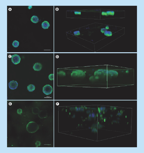 Figure 4.  Matrigel at a concentration of 75% is optimal for 3D culture of MCF-12A cells.Representative single confocal images (A, C & E) or serial Z-stacks (B, D & F) of MCF-12A cells embedded in 50% (A & B), 75% (C & D) or 100% (E & F) Matrigel and immunolabeled with an E-cadherin antibody (green). Nuclei are stained with 4′,6-diamidino-2-phenylindole (blue). Scalebars: 100 μm.