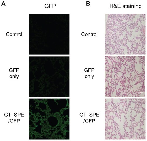 Figure 2 In vivo gene transfer analysis after aerosol delivery to lungs. (A) Transfection efficiency study: GFP expression analysis (Magnification, 200×). (B) Lung histopathology study: H&E staining (Magnification, 200×; scale bar, 50 μm).Abbreviations: GFP, green fluorescent protein; GT–SPE, glycerol triacrylate–spermine; H&E, hematoxylin and eosin.