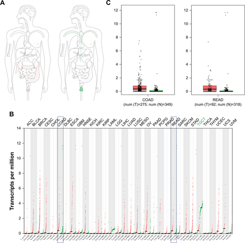 Figure S1 The expression of ACTL8 gene and protein was determined by big data analysis.Notes: (A) The median expression of ACTL8 in tumor and normal samples in bodymap in Log2(TPM +1) Scale pattern. (B) The ACTL8 gene expression profile across all tumor samples and paired normal tissues (dot plot; each dot represents expression of samples). (C) The two box plots show the expression of ACTL8 gene in colon adenocarcinoma (denoted as COAD) and rectum adenocarcinoma (denoted as READ) and paired normal tissues. Red represents cancer tissues; green represents normal tissues. The data were obtained from GEPIA, and the data matched TCGA normal and GTEx data.Abbreviations: GEPIA, Gene Expression Profiling Interactive Analysis; GTex, Genotype-Tissue Expression; TCGA, The Cancer Genome Atlas.