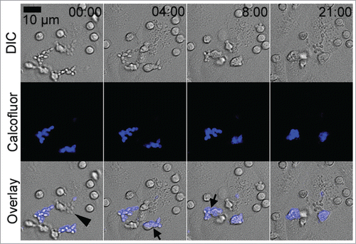 Figure 8. PMN migrated on the endothelial monolayer to phagocytose adherent C. parapsilosis. Top row shows DIC, middle row shows calcofluor+ extracellular yeast cells, and the bottom row shows the overlay. Time is shown in minutes and seconds. Arrows show PMN in the process of engulfing a cluster of adherent yeast cells. Internalized yeast cells (calcofluor−, arrowhead) appeared to be ignored by apically migrating PMN. Data are also shown as movie 3 in the supplemental material.