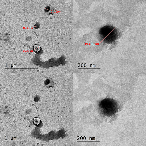 Figure 6 Transmission electron microscope (TEM) pictures of an Optimum CsA-DTH -Cerosomes (C-D12).