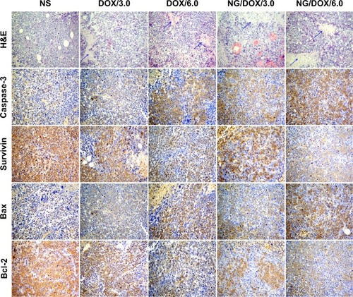 Figure 6 Histopathological and immunohistochemical analyses.Notes: Histopathological (ie, H&E) and immunohistochemical (ie, caspase-3, survivin, Bax, and Bcl-2) analyses of tumor tissues sections after treatment of NS as control, or free DOX·HCl or NG/DOX at a dosage of 3.0 mg or 6.0 mg DOX·HCl equivalent per kilogram body weight. The arrows indicate the typical necrotic area. Magnification: 200×.Abbreviations: DOX, doxorubicin; DOX·HCl, doxorubicin hydrochloride; H&E, hematoxylin and eosin; NG/DOX, DOX-loaded nanogel; NS, normal saline.