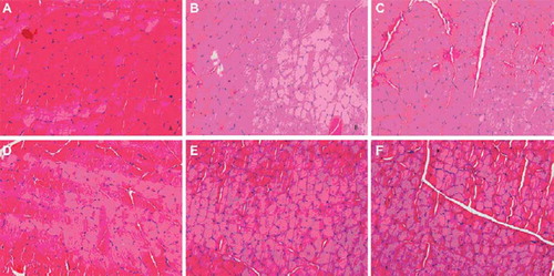 Figure 1. Images of the transverse section of the Tibialis anterior muscle (Hematoxylin-Eosin stain, X400), compared to the normal muscle of the contralateral control side (A); muscles of the experimental side revealed atrophy with the average diameter of the muscle fiber progressively reduced when the distal nerve stump suffered 0–8 weeks degeneration before repair: fresh-repaired (B); 1-week degeneration (C); 2-weeks degeneration (D); 4-weeks degeneration and 8-weeks degeneration (E).