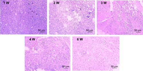 Figure 5 Inflammation responses to PS/gelatin at different time points postsurgery (black arrows: giant cells; scale bar =50 μm).Notes: 1 W, 2 W, 3 W, 4 W, and 6 W indicate 1 week, 2 weeks, 3 weeks, 4 weeks, and 6 weeks, respectively.Abbreviation: PS, polystyrene.