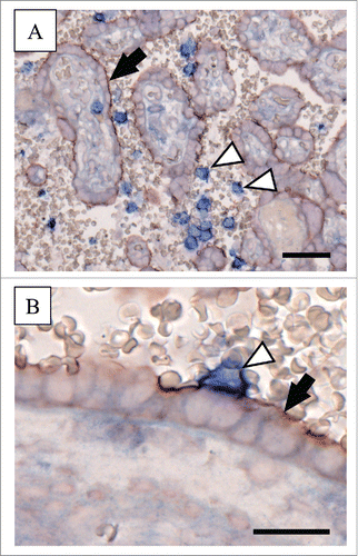 Figure 2. Immunohistochemical double staining for fractalkine and CX3CR1 in human term placenta Human term placenta sections (5 µm) were stained with the MultiVision Polymer Detection System (Thermo Scientific), using monoclonal anti-human CX3CL1/fractalkine antibody (clone 81513, R&D Systems, 1 µg/ml) and polyclonal anti-CX3CR1 antibody (C8354, Sigma-Aldrich, 0.5 µg/ml) as previously described.Citation21,29,38 (A) Immunohistochemical double staining of human term placenta localized fractalkine at the apical microvillous plasma membrane of the syncytiotrophoblast (red staining; arrow), whereas CX3CR1 was detected on circulating maternal blood cells (blue staining; arrowheads) in the intervillous space. (B) Tight contact of the fractalkine positive syncytiotrophoblast (arrow) and a CX3CR1 expressing maternal blood cell (arrowhead) was occasionally observed and suggest fractalkine/CX3CR1-mediated fetal-maternal interaction. Scale bars in Aand Brepresent 50 µm and 20 µm, respectively.