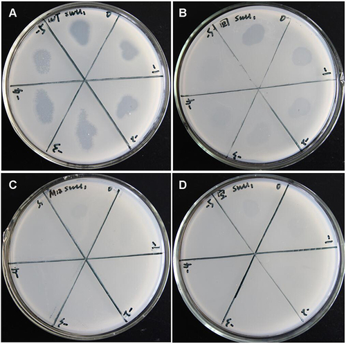 Figure 8 The sensitivity of M12_pNIT_MSMEG_0392 to SWU1 was detected by Direct Spot Test. (A) M. smegmatis mc2 155 and (B) M12_pNIT_MSMEG_0392 can form obvious plaque for SWU1. (C) M12 mutant strain and (D) M12_pNIT_Myc cannot form plaque.